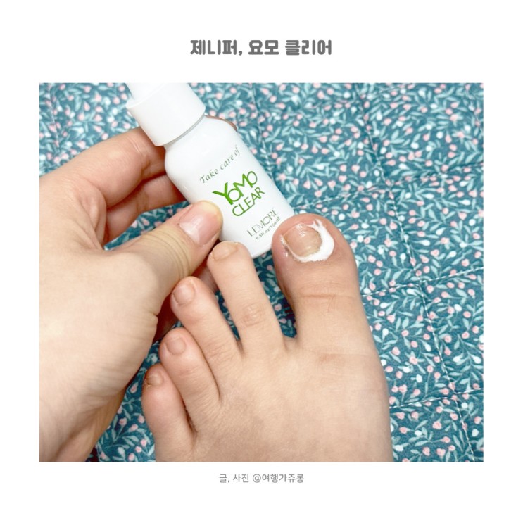 무좀발톱 클리어 집에서 혼자 관리하는 요모클리어