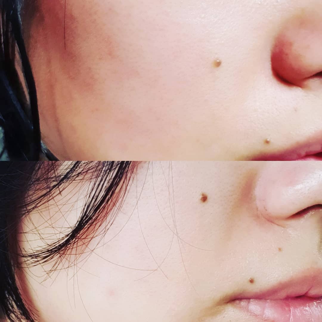 @suin_hp on Instagram: “2주 이상 써보고 확실히 미백에 증진이..😭 전성분 안전하고 착한 아이들인데 참 좋은데 더 설명 할 길이 없댱.. 앗 그리고 피부 컨디션 안좋은 날엔 사용하면 조금 따가워용  이게 피부진정 해주는 성분이 피부 진정에 도움을 주는 거래요!  수분감도…”