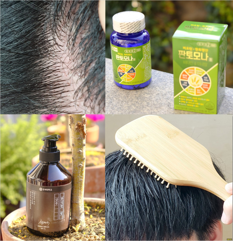 탈모치료제 TOP 4, 제품별 완벽분석: 부작용, 섭취방법, 성분