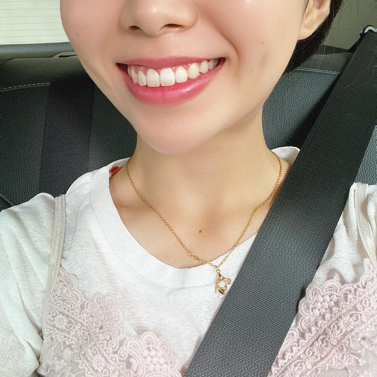 .
드디어 교정 끝-!
이제 나도 활짝 웃을 수 있다!😆♥️
.
자세한 후기는 블로그에
👇👇👇
프로필하단 링크 있어요!
#아이디병원