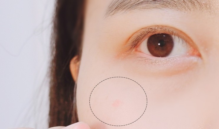 흉터컨실러 오른쪽 눈 밑 빨간흉터 커버해봄 미국직구