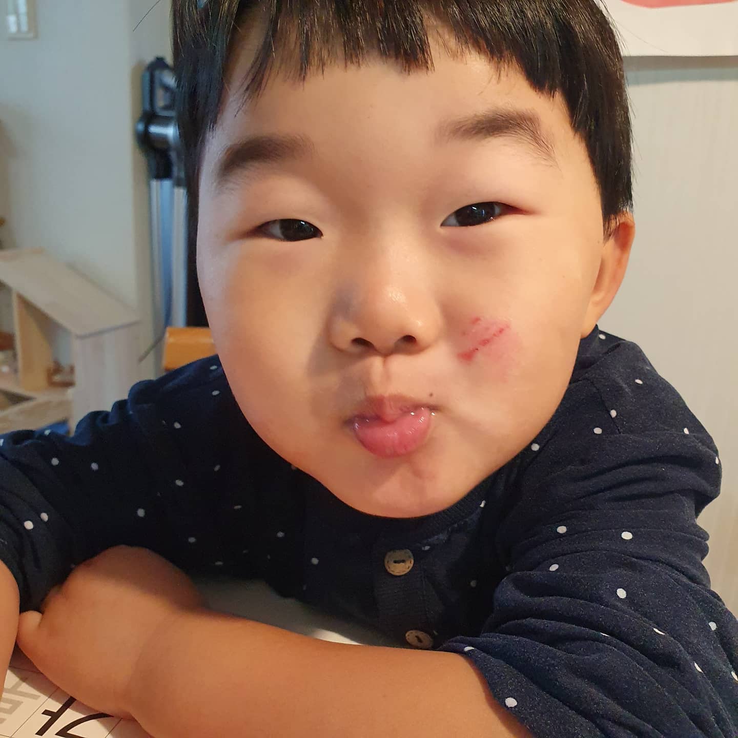 #우우남매일상👫 

딸내미가 긁은 내아들의얼굴
요즘 날이 건조해 아토피가 살짝올라와
신경쓰이던 애미였는데...

싹 긁어도 아토피 올라온곳을
긁을께 뭐람

앏아진피부 바로 피질질
화가 머리끝까지 🔥 
그런데도 우지니는 
은우가 일부러그런거아니라며
엄마는 혼내기만한다며
우지니한테 한소리듣고
나보다 어쩔땐 더나은 내아들을보며
오늘도 #반성의밤
#나도엄마가처음이야
#나도사람이야