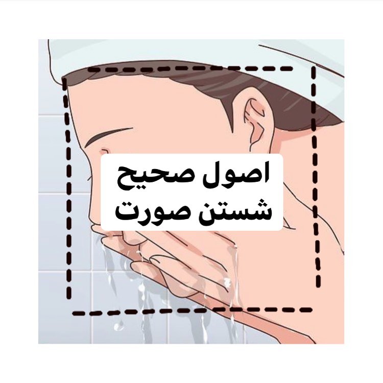 خب خب توی این پست  میخوام بهتون بگم که صورتتون رو چطوری بشورید 
چون پوست صورت یکی از جاهای حساسه بدنه و باید مراقبش باشیم😍

🦋شستن با آب تنها برای زدودن کثیفی‌‌های چسبیده به صورت کمک نمی‌کند

🦋بهترین روش تمیز کردن صورت، شستشو با آب و صابونه
باید روزی دو بار صورت را با آب و صابون شست. شستشو نباید بیش از دو دقیقه طول بکشه. نوع صابون را بسته به نوع پوستتون و با مشورت پزشک انتخاب کنید

🦋صابون زدن و شستن پوست صورت يكي از اقدامات بهداشتي مراقبتي براي حفظ سلامت و شادابي پوسته ، اما همين اقدام در صورت غير اصولي بودن باعث گسترش جوشها ، آكنه و ضايعات عفوني پوست صورت میشه

🦋به طور معمول، شستن صورت ۱یا۲ بار در روز کافيه و بيشتر از اون میتونه باعث ناراحتي پوست و توليد بيشتر چربي بشه. در روزهایي که صورتتون رو آرايش نکرديد، يا از ضد آفتاب استفاده نکرديد، نيازي نيست از تميز کننده پوست استفاده کنيد کافيه صورتتون رو با آب ولرم بشورید

🦋آب گرم منافذ رو باز مي کنه و آب سرد، منفذ رو میبنده. هر چند استفاده از آب گرم احساس خوبي ايجاد میکنه اما باعث از بين رفتن روغن طبيعي پوست و خشکي بيش از حد پوست ميشه. آب ولرم بهترين گزينه براي تميز کردن پوسته

🦋استفاده از محصولات بهداشتي حاوي عطر، رنگ و مواد نگهدارنده مصنوعي مثل «پارابنز»، ممنوعه. سديم لوريل سولفات که بيشتر توی شوينده هاي صورت موجوده، علت شايع واکنش هاي حساسيت زاست. به همين دليل قبل از خريد به برچسب ها توجه کنيد

🦋پس از شستشو، صورتتون رو با حوله خشک کنید. برای خشک کردن نباید حوله رو به صورتتون بکشید، بلکه فقط کافیه حوله رو با پوست صورتتون تماس بدین و به آرومی روی نقاط مختلف صورت فشار بدین

🦋موقع خشك كردن صورت بايد توجه داشته باشين كه اگر حوله رو روی پوست صورت بکشین، ميكروب ها و عوامل بيماري زاي موجود در يك جوش كوچیک رو با دست خودتون روي پوست صورت پخش كردین كه احتمال افزايش جوش ها را در صورت به وجود میاورد

🦋یکی از دلایل پیری زودرس و پیدایش چین و چروک و خشونت پوست، خشک کردن پوست با حوله به روش خشنه. بعد از خشک کردن صورت یک کرم مرطوب کننده روی پوست صورتتون بمالید تا رطوبت پوست حفظ بشه

سوالی داشتین همین زیر واسم کامنت کنید🥰🧖🏻‍♀️💕

#راپونزل #مراقبت_پوست #پوست #پوست_سالم #پوست_صاف