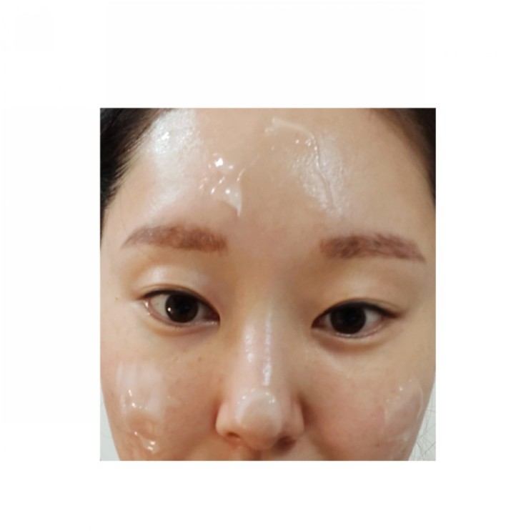 티크림/줄기세포화장품/여드름화장품 - "에스엔 티 크림" 리뷰 ★