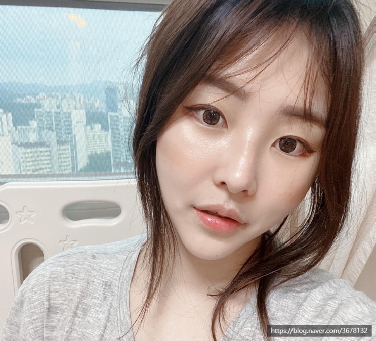 [출산후 피부 탄력 케어]실루엣 소프트 리프팅 한달 차 후기(ft. 볼패임 완화, V라인 소생😆)