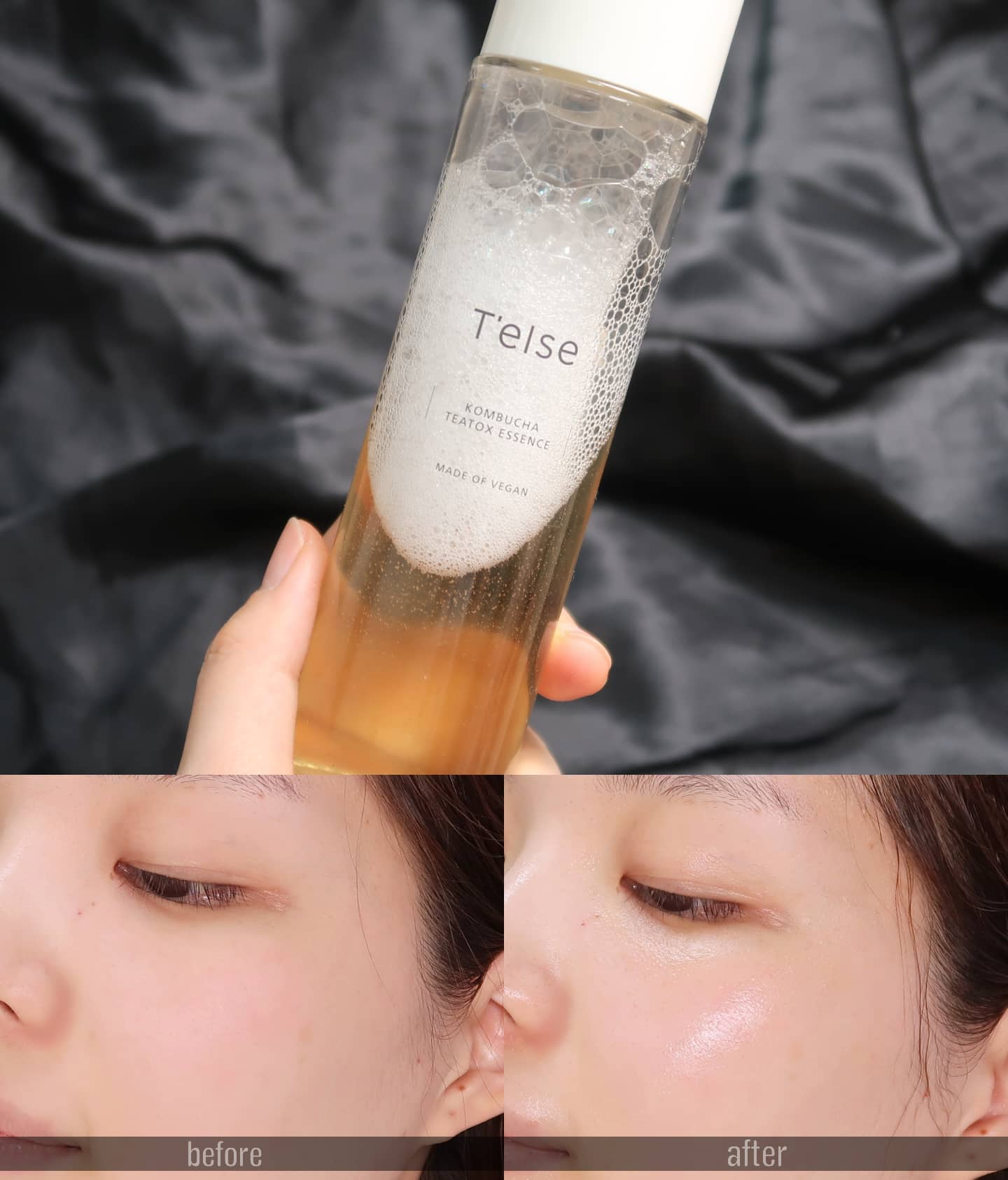 요즘 들어서 날씨가 너무 추워져서 그런지, 세안하자마자 토너보다는 콤부차 티톡스 에센스를 더 먼저 찾게 되는 것 같아요◡̈

피부가 유독 건조하게 느껴지는 날에는
화장솜에 아낌없이 팍팍 묻혀주어 스킨팩 대용으로 사용하기엔 딱이랄까요!
 
피부 속건조는 빠르게 잡아주고
끈적이거나 번들거림 없이 쫀쫀하게 마무리되니 더더욱 만족스러운 제품! 

이번에 2021 올리브영 어워즈 클린 뷰티에 선정됐다고 하니 더더욱 반가웠던 티엘스 콤부차 티톡스 에센스!

보다 더 자세한 후기는 제 블로그를 참고해 주세요!

#ad#비건화장품#에센스추천#콤부차#비건에센스#클린#비건#vegan#콤부차에센스#kombucha#올리브영에센스#콤부차1위에센스#약산성에센스#워터에센스#티엘스#피부다도#2021올리브영어워즈#클린뷰티#콤부차발효의힘#피부나이를멈춰보세요