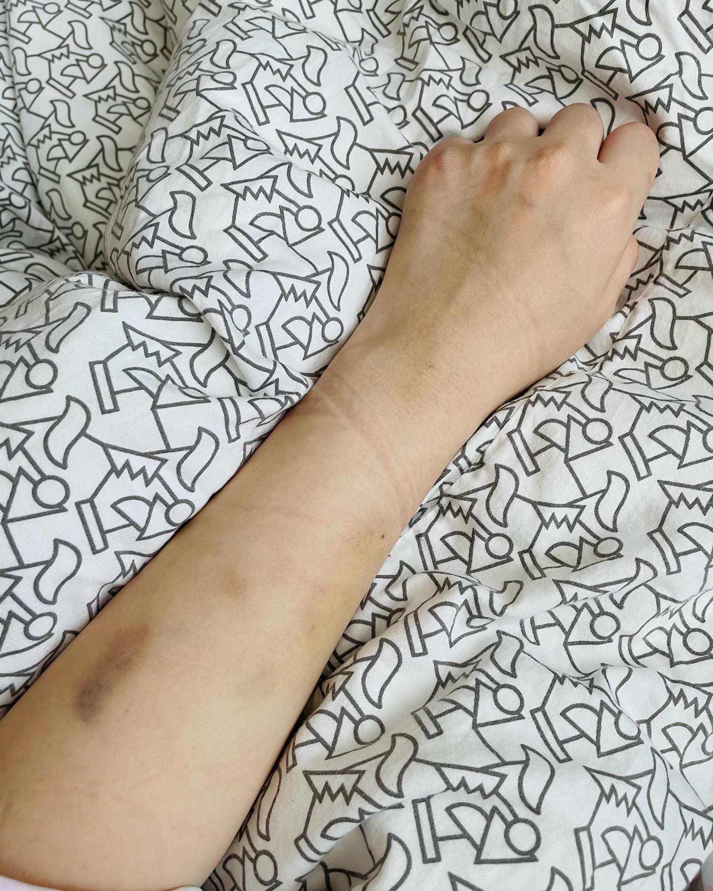 .

평소에 주사바늘 그렇게 싫고 혐오했는데
진통 겪고나니 뭐든 괜찮아요오- 가 되었다.
출산하고 혈관이 약해진탓인지 철분 주사
맞는데 혈관이 다 터졌버렸다 😂

뭐든 괜찮아,
엄마된지 D-4 👩🏻‍🍼