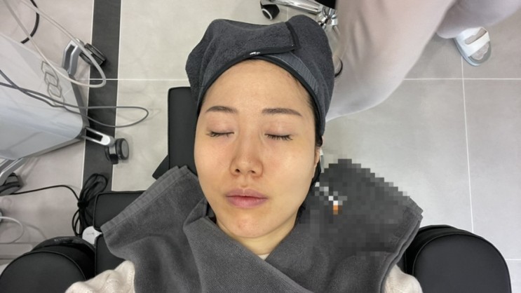 위례피부과 인모드 슈링크 피부관리 받고 1주차 된 후기 올려봅니다!