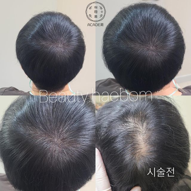 망바🥭🍌👻 on Instagram: "#광고 왁싱, 반영구화장, 두피smp 수강전문 `뷰티해봄` 이번에 이수역 도보 1분거리에 반영구화장전문 아카데미가 신규 오픈되었어요. 경력 10년 원장님이 운