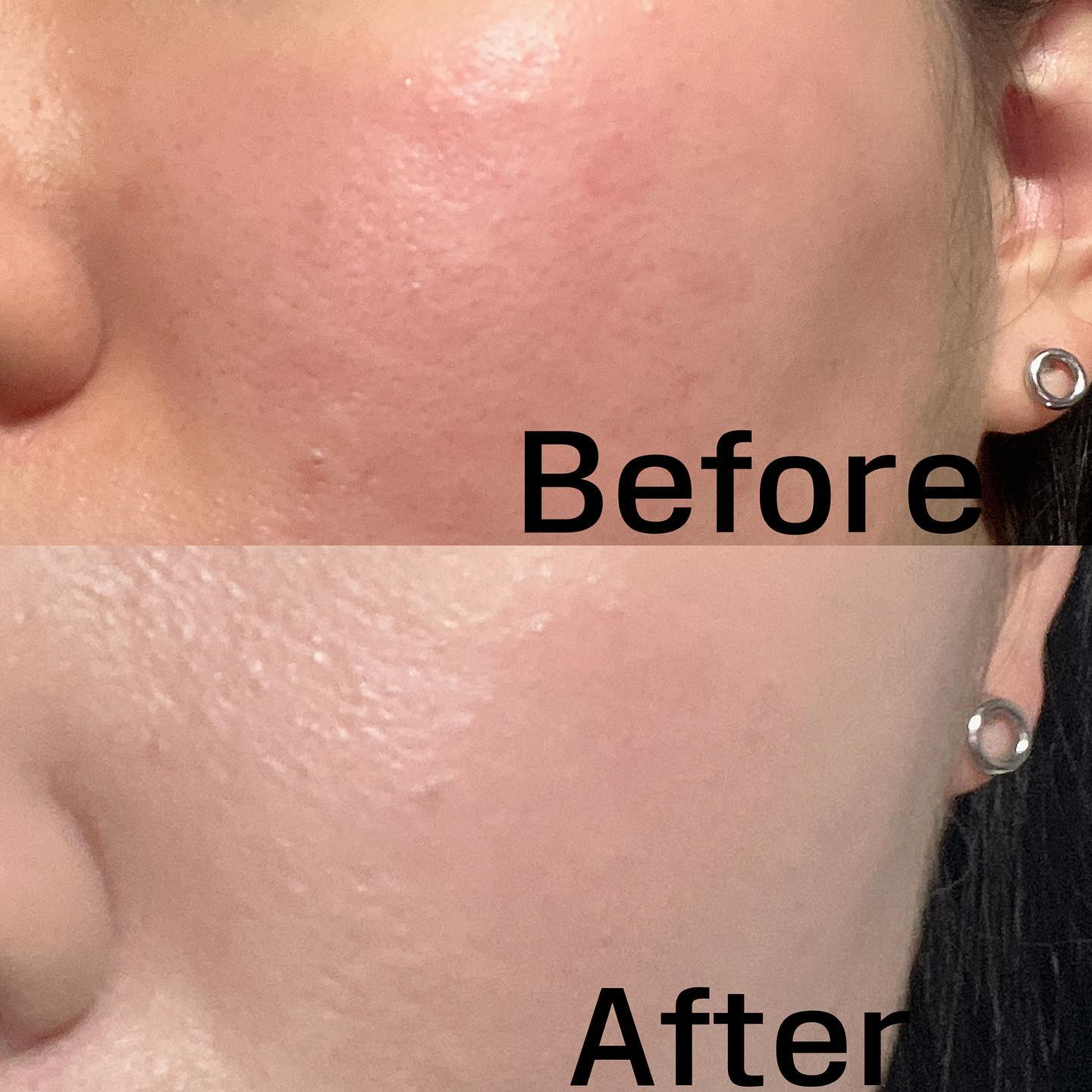 #제품제공 #루나 
luna_makeup_official 

겨울에도 보송보송 매트한 파데를 쓸 수 있다…? 정답은 o!!!
루나의 살결파데랑 함께라면 지성피부도 복합성 피부도 유분폭발 걱정할 것 없이 쓸 수 있고, 건성도 건조함 걱정없이 쓸 수 있는 베이스에요💕

저는 겨울이라 스킨케어를 꼼꼼히 해주는 편이라, 스킨케어 흡수 후 위에 요 파데 올려줘도 건조하다는 느낌 전혀 안들었고, 오히려 속광도 살짝씩 돌아서 넘 신기했어요!! 피부가 편안하고 답답하단 느낌이 거의 안 드는 제품이라 요즘 나갈 때 계속 쓰고 있어요!!

#살결파데 #롱래스팅파운데이션 #루나파운데이션 #복세편살체험단 #코덕 #코덕리뷰 #코덕맞팔 #코덕맞팔환영 #파데 #파데추천 #파운데이션 #겨울 #겨울파데 #루나파운데이션 #루나코스메틱