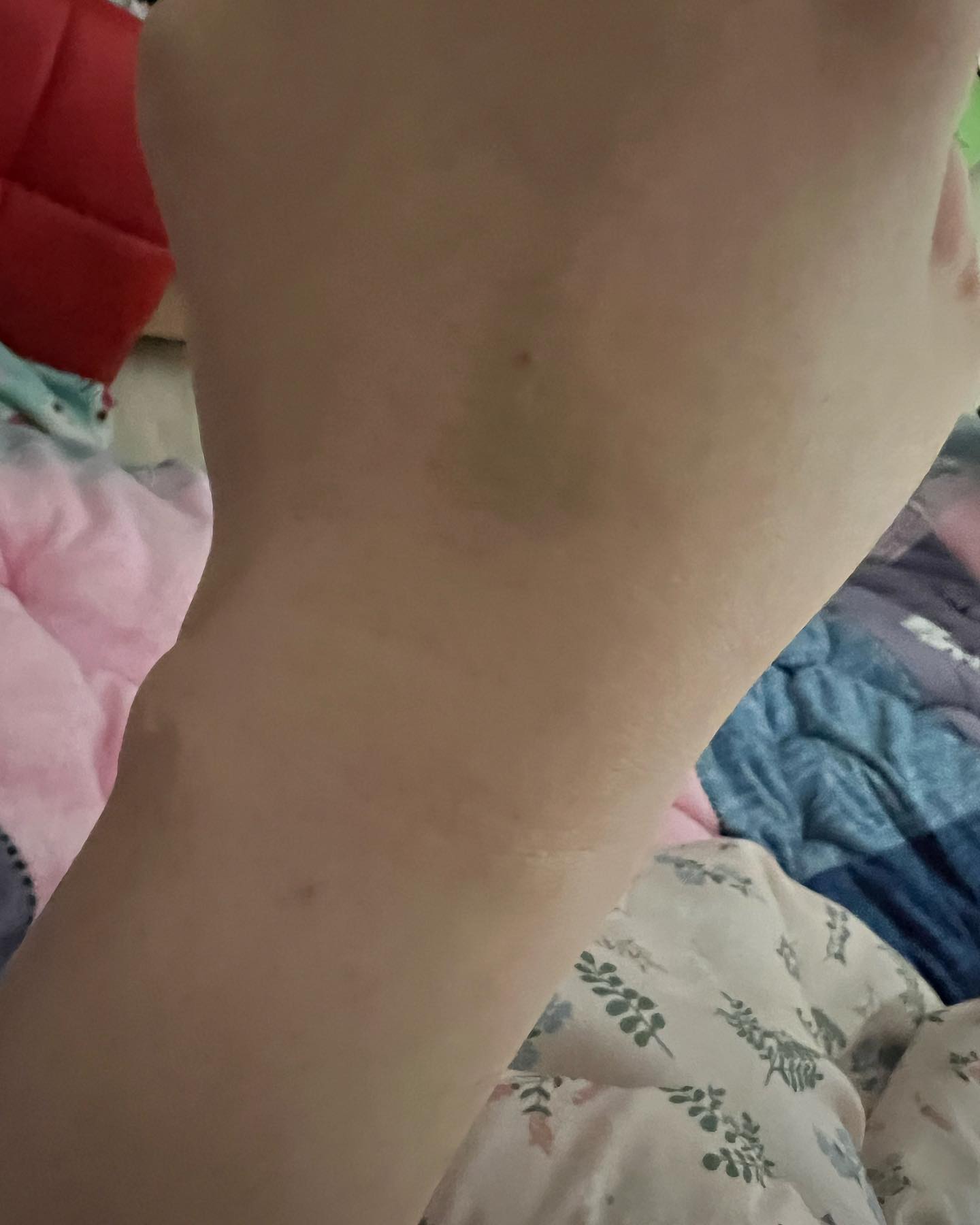 혈관이 없단다 
그럼 나는 대체 피가 어디로 흐르는것인가
링겔 놓을곳이 없어서 팔뚝까지 올라가서
겨우잡으면 겁나 아프지만
이제 몇번씩 꼽았다 놨다 하는것쯤이야
껌이지 머 혈관이 움직이고 숨고…
참 나답다오…케케케

낼 피검사 받으러 가는 날인데
미뤄야겠다 감기걸려서 해롱이 됨
감기 독하다니 감기 조심하세여 ㅠㅠ
열나고 누가 내몸을 즈려밟은듯 ㅠㅠㅠ

.
.
.
.
#투병 #감기 #혈관 #아파 #살려줘 #일상 #채니 #힘내자