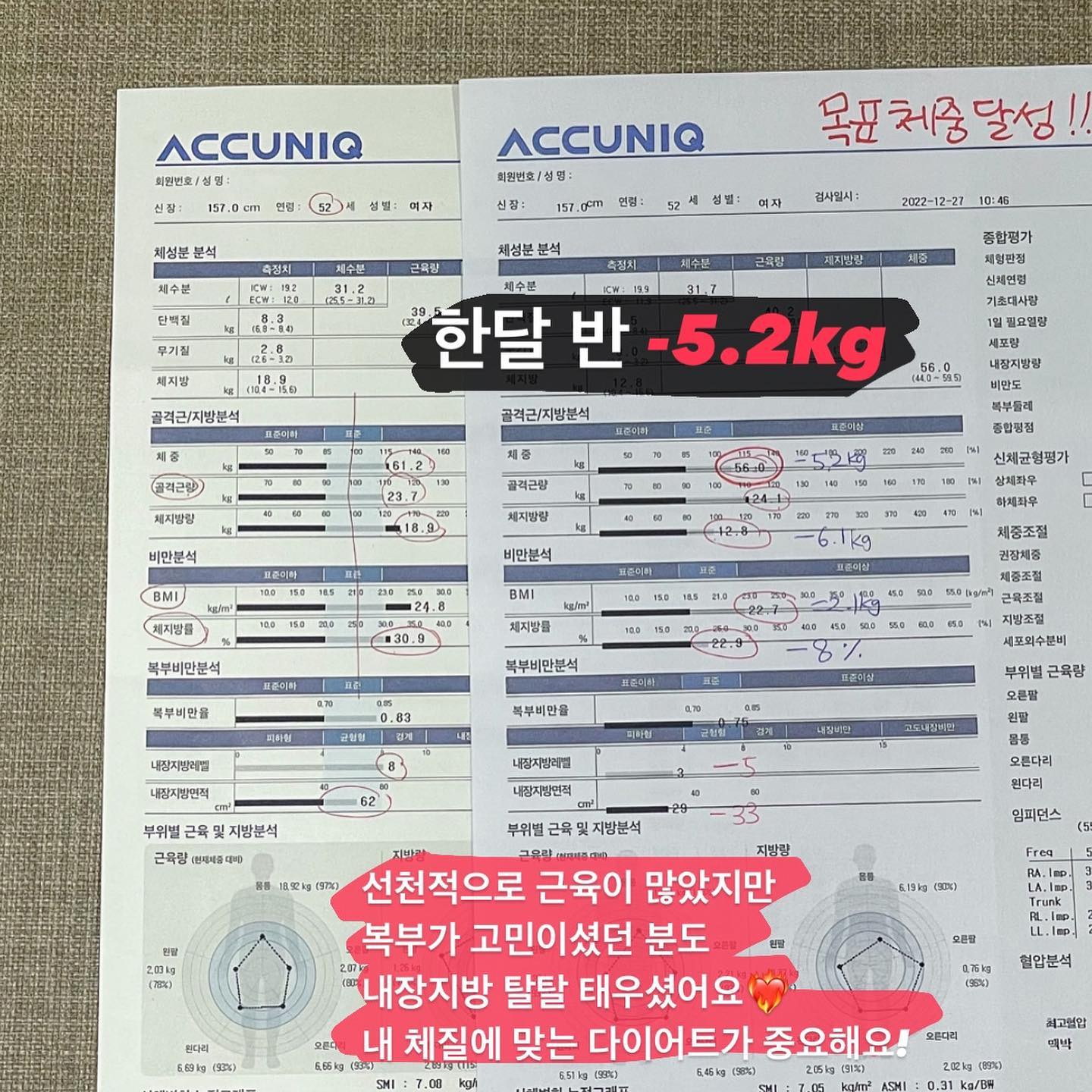 따로 다이어트는 홍보하지 않았는데,
성공하신 분들이 가족들 데려오시고 있네요🙊
멀리 강서에서부터 오셔서 약 지어가신다니 감동,,
개원한지 얼마 안됐는데
다이어트 한약 맛집으로 입소문 나부렸어요
(물론 맛있다는거 아니고요^^..)
⠀
✅역하지 않은 한약
✅고가의 약재가 마구마구 들어간 한약
✅스트레스 받지 않는 다이어트
✅건강하게 하는 다이어트
✅다이어트하면서 체질 개선까지!
⠀
다이어트 건강을 위해서도 필요하지만
사실 자기 만족이 크잖아요😊
날이 더워지는 만큼 옷 얇아져요~
내일로 미루지 말고 맘 먹으셨을 때 시작하세요!
⠀
코로나라 비대면 처방도 가능해서
사정상 내원이 힘드신 분들도
원장님과 전화 상담으로 처방 가능:)
⠀
⠀
식단 조절이 힘든 분,
운동하시기 힘든 분,
시간이 없으신 분,
⠀
⠀
대부분 방법은 알고있지만 실천하기가 힘든 다이어트!
나를 믿지 마세요, 저희 한의원을 믿으세요!😂
⠀
프로필하단 링크 클릭하셔서
카카오톡 문의 주세요
⠀
*인스타보고 문의 주셨다고하면
원장님 쫄라서 할인받아올게요💃
⠀
#직장인다이어트
#주부다이어트
#다이어트한약추천