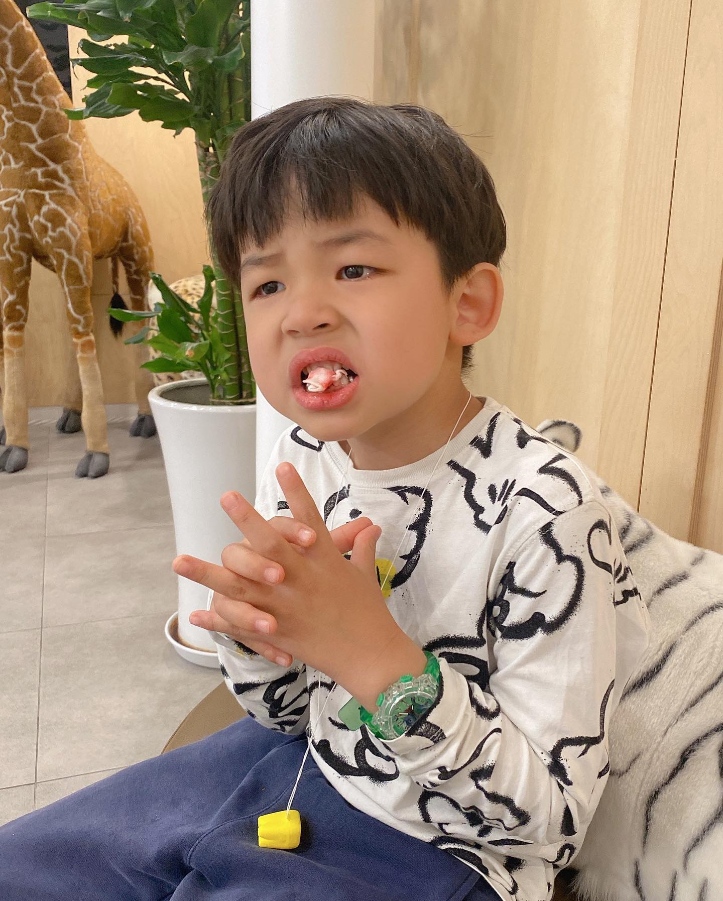 230504 #첫발치
지난 달 갑자기 아랫니 영구치가 먼저 올라와버렸다
이대로 흔들리지 않으면 주사마취해서 생니를 뽑아야하기에 조마조마하던 중에 다행히 흔들리기 시작했고
이가 흔들려야 안아프게 뽑을 수 있다는 말에 매일 부지런히 이를 혓바닥으로 밀어댄 윤우 덕에 무사히 발치 성공 :)

마취약 바르신다더니 순식간에 뽑아버린 노련한 쌤👍
울려고 자세잡는데 이미 뽑힘ㅋㅋㅋㅋㅋ
뽑힌 이가 너무 하찮을 정도로 작다🤭ㅋㅋㅋㅋㅋ

👩🏻 빠진 이 배게 밑에 넣어두고 tooth fairy한테 사가라고 할까?
👦🏻 (동공지진) 왜.....? 시른뎅...?
👩🏻 그러면 숲반 지붕위로 던져서 까마귀가 물어가고 새이빨 가져오라고 할까?
👦🏻 (뒷걸음질) 나 이거 너무 소듕해서 보물상자에 넣을건데..?

ㅇㅏ... 그래...

#엄마도그거필요없어🤷🏻‍♀️
#다모아라모아

#생각보단순탄하게발치성공