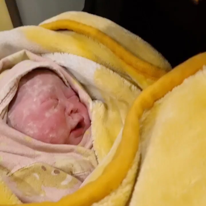 .
.
#공다인
#탄생👶🏻👶🏻👶🏻
.
.
#37w5d
#2.8kg
#토끼띠공주님🐰
.
.
10달 가까이 함께였던 꼬맹이와
드디어 떨어졌습니다 ~🙈
.
.
새벽3시 가량부터 시작된 진통과
오후3시까지도 더이상 진행이되지 않던
자궁문 ㅠㅠㅠㅠㅠㅠ
똑똑 누구 안계셨나요ㅠㅜㅜ😭😭
.
어쩔수 없이 #제왕절개 를 선택하고
아기를 만나게되었어요!
아직 품에 안아보진 않았다는....😂😂
.
.
아기를 잘 만나게 도와주신 많은 분들
특히 개언니옵빠 봐주고 있는 이모들 ㅠㅠ
harrrong blanc__jel _blumenladen 진짜 감사하구ㅠㅠ
꼬아빠두 앞으로 고생이겟지만..... 고맙구
안부 물어주시고 걱정해주시고
함께 기뻐해주던 모든 가족과 지인분들께 감사드립니다 🥰🥰🥰
.
.
.
세상 누구보다 슬기롭고
배운 지혜를 다져서 현명하게 사는
다인이가 될수 있도록 잘 키울게요!🥰🥰
.
.
개언니옵빠와도 건강하게 잘 지낼수있도록
응원해주세욥! 빠이팅!!!!🐶👶🏻🐶👶🏻
.
.
#토끼띠맘
#애개육아
#자연분만실패!!🙈🙈
#보스턴테리어
#비숑프리제
#꼬맹아잘해보자🥰