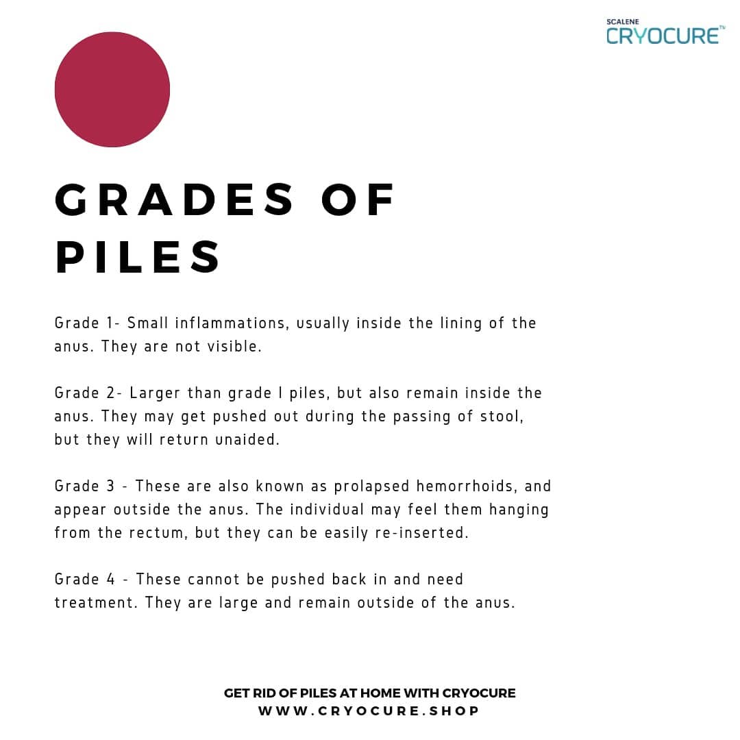 Did you know that there are four different types of piles? If you, or anyone you know is suffering, help them identify their piles by sharing this with them.
Keep in mind Piles can be treated at home with CryoCure, the world’s best cryogenic piles treatment. 
Learn more on www.cryocure.shop

#pilessurgery #pilesmedicine #piles #pilescure #pilestreatment #hemorrhoidectomy #hemorrhoids #hemorrhoidsurgery #health #hemorrhoidtreatment #fissures #healthy #healthybody #nosurgery