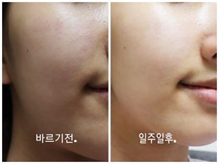 도아맘🐰 (이시연) on Instagram: “갑자기 제 피부사진 눈뽕 죄송요..☺ 제가 좋은 아이를 찾아 소개하려고 후기 사진을 올리네용 ㅎㅎ 일주일간 사용해보고 올려요~ 일주일간사용해보니 미세먼지 차단 효과는 사실 제가 느끼지 못하니 잘알수는 없지만 보습효과는 짱짱한것 같은 아이에요~바르고…”