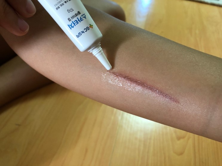 GC녹십자 흉터제거연고 '스카터치 블레미쉬겔' 2주사용 후기