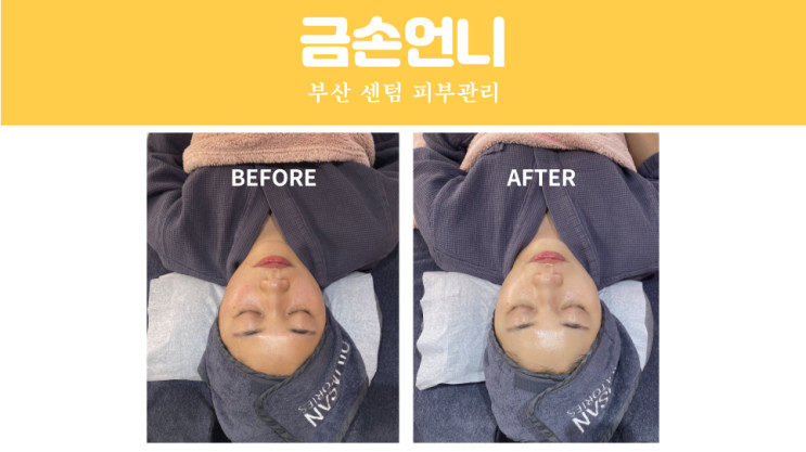 부산 센텀피부관리/해운대피부관리 잘하는 곳 '금손언니' 솔직 후기