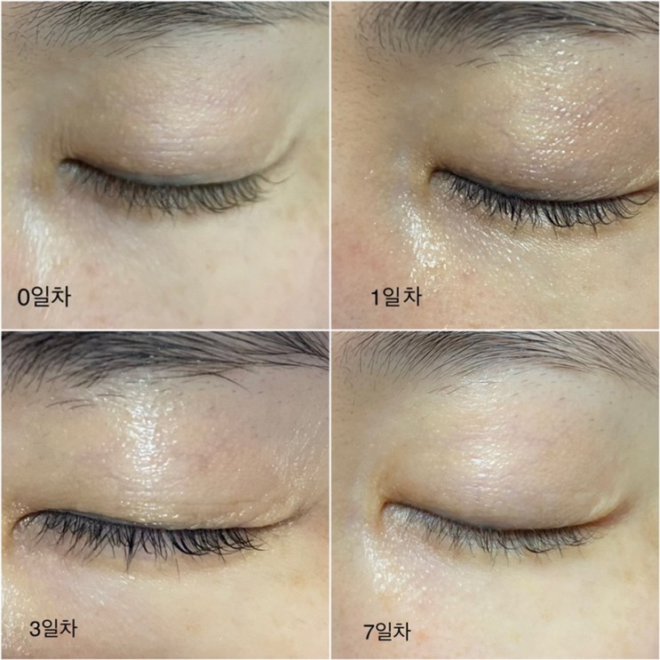 모빈스지 | 한방아이크림 항산화 네이플아이크림