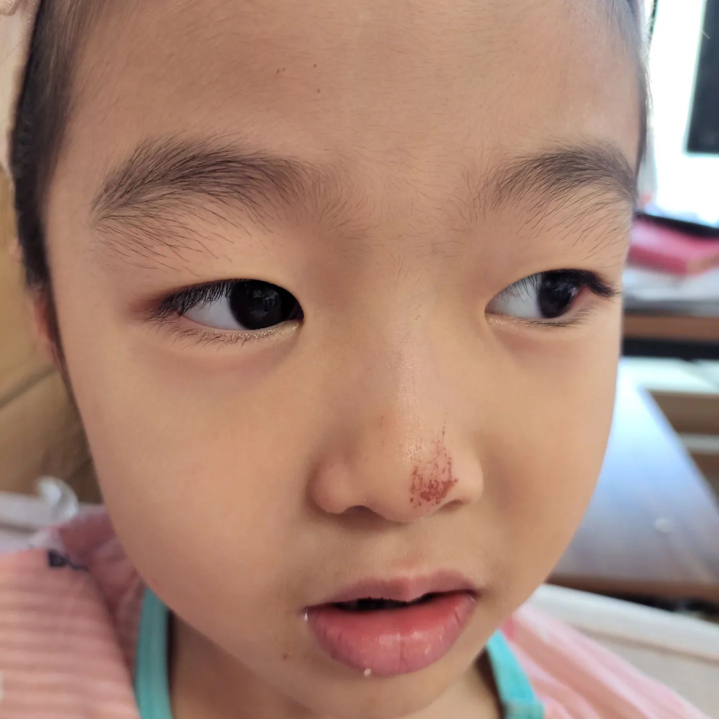 그네타다가 꼬꾸라졌지뭐예요ㅜ
비판텐발라줘야겠어요.
비판텐은 기저귀발진있을까봐 사뒀는데 이리저리 막쓰기 편하네요ㅎㅎ

#아이상처 #아이상처관리 #아이상처연고 #아이상처치료 #비판텐 #비판텐연고 #육아소통 #6세 #6세딸 #6살 #6살딸 #6살아기 #6살딸램