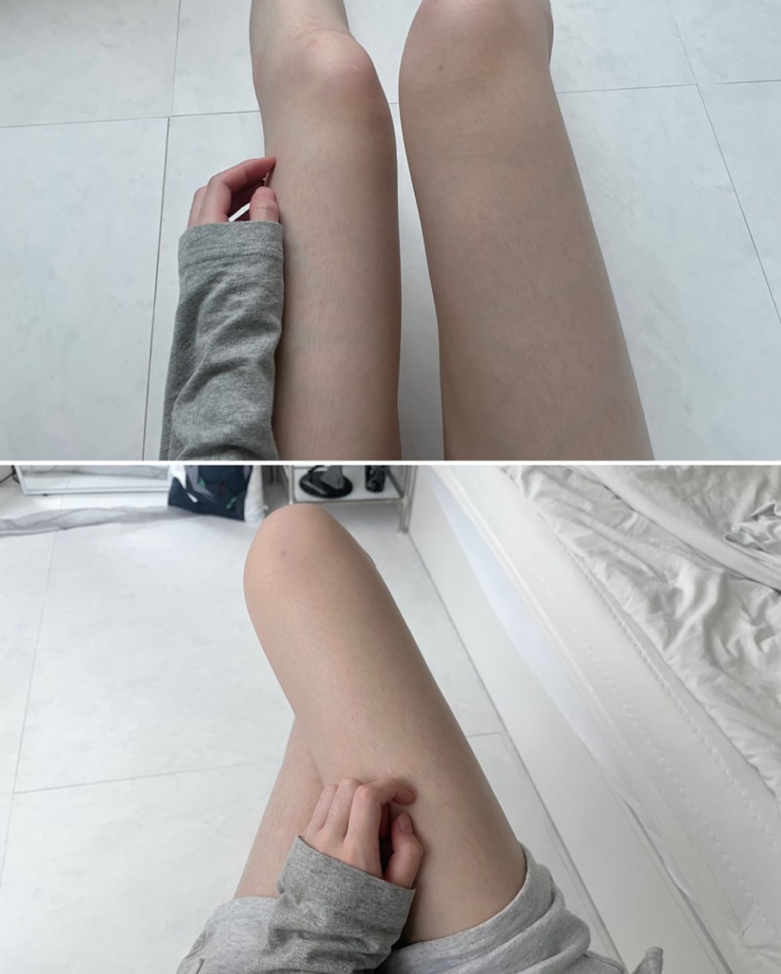 바닥에서자면안되는이유..다리뼈잇는곳에다멍든다🖕🏻