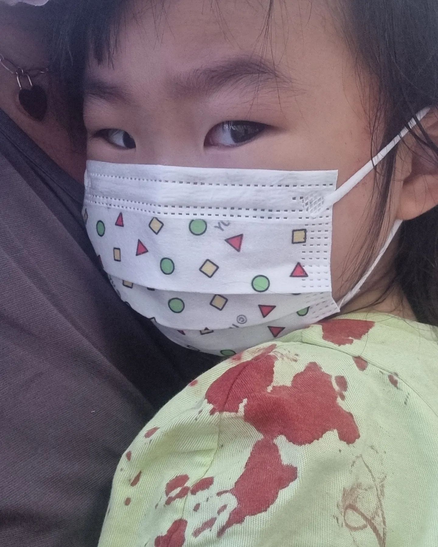 하아...
자다가 침대서 떨어져서 머리찢어짐..
1.5cm찢어져서 찝음
응급실서 울고 불고 항생제,진통제 맞고 귀가
방바닥에 피가 흥건..
아침부터 놀래서 나도 같이 울고 😢
당분간 씻지도 못하는데
예원이한테 피비릿내가 진동하네
.
.
.
#20230625  #생후1510일
#49m17d #자나깨나조심