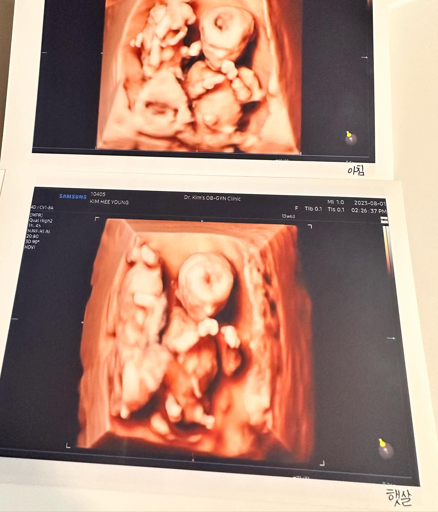 연년생을 갖자던 남편과의 계획은 이루어졌다. 일란성 쌍둥이 임신에 옴총 놀랐지만…ㅠㅎㅠ 기쁘고 감사한 마음으로 잘 지내보쟈구🧡 아침&햇살이 :)

+이와중에 쑥쑥크는 첫찌 #엘쀼👼