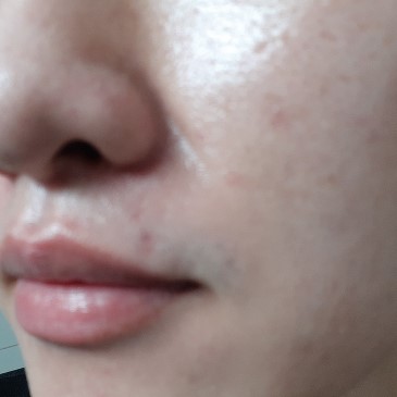 미세먼지 가득한 날, 피부 탄력이 없는 날엔 디세라피 멀티 헤드 모션 클렌저