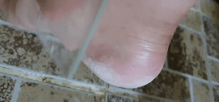 발각질제거추천, 툴라유리풋파일