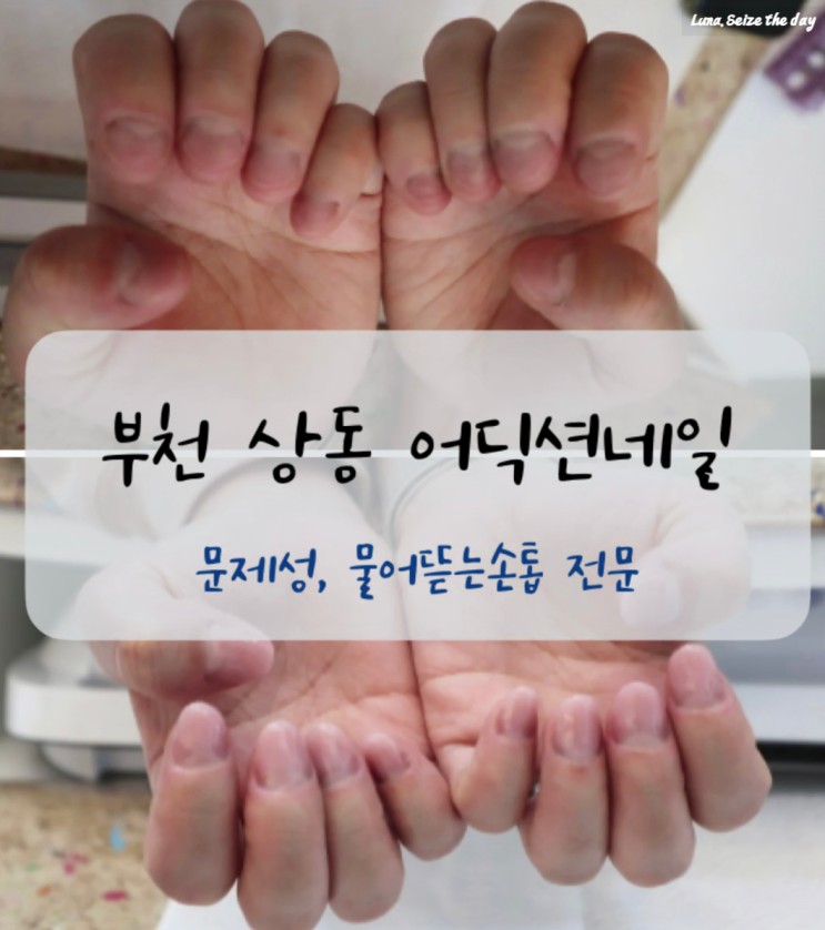 부천 상동역 어딕션네일 : 물어뜯는 손톱 관리받기 ft. 문제성손톱관리, 파고드는 내성발톱, 부천 문제성손톱 전문 네일샵