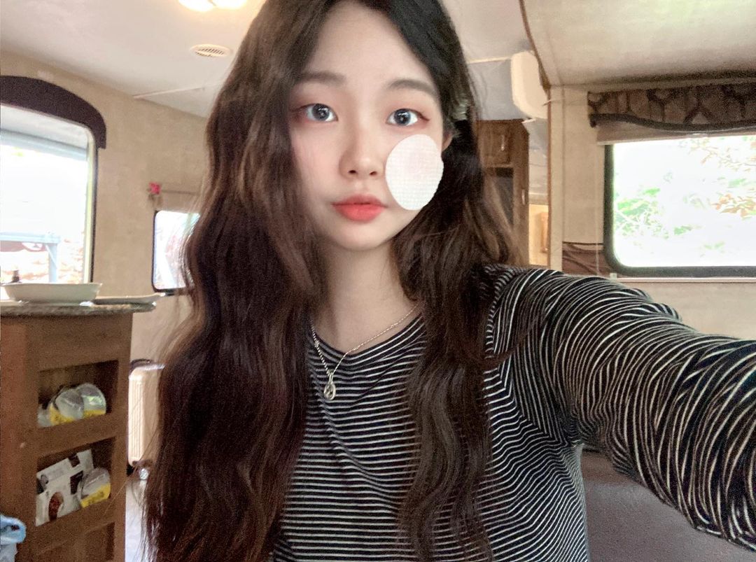예지 on Instagram: “#협찬 순하고 촉촉한데 간편해서 여행와서도 사용하는 슈퍼시카패드 !! 갑자기 뒤집어진 피부 때문에 알아보다 진정패드로 유명한 슈퍼시카패드 써봤어요 :) 메디큐