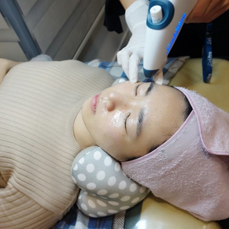 문정동피부과에서 쿨리프팅 받고 히알루론산충전했어요!~