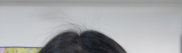 여자탈모인의 비오틴영양제솔직후기 [나만의건강by설리마켓] 맥주효모비오틴 솔직리뷰