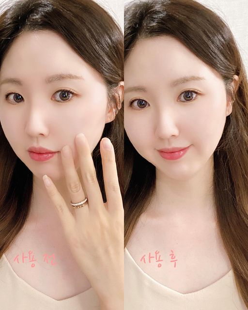 @luvely_yh on Instagram: "#협찬 울님들💓 물광 리프팅에 탁월한 황금 비율로✨ 유효 성분을 가득 담은 고기능 콜라겐 버블세럼🫧 메디큐브 '딥 콜라겐 글로우 버블세럼' 사용해봤어요!😘🧡 쫀
