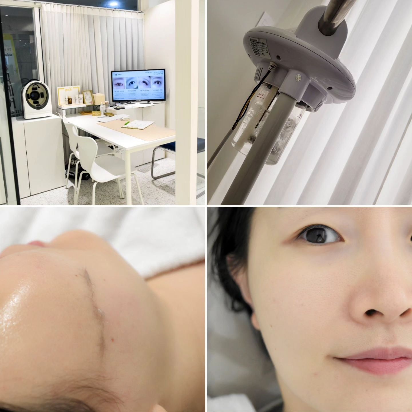 #협찬
#대구수성구스킨플래닝 받아본 느낌

이번에 소개해 드릴 제품은 바로 "대구 수성구 #스킨플래닝 을 받고 온 아트뷰티"입니다.

얼굴의 묵은 각질을 제거해 주고 싶었는데 이게 그런 느낌이라고 하더라고요! ㅎ
한 번도 받아본 적이 없어서 궁금했답니다.

얼굴에 잔털이 없을 줄 알았는 데 있어서 신기했어요:)
사진으로 담아보았는데 깨끗해지는 느낌이 기분이 좋았답니다.

하고 나서 주의할 점에 대해서도 알려주셨는데요:)
부드럽다고 얼굴을 손으로 만지면 안 좋다고 말씀해 주셨답니다.
그리고 보습과 재생 관리를 다른 날보다 더 신경 써줘야 합니다.
목욕탕이나 사우나 수영장 바닷물은 일주일 이후에 방문이 가능해요:)

대구 수성구 스킨플래닝 받아본 느낌을 설명드리자면 우선 얼굴이 매끈해진 느낌이 들었어요:)
그리고 얼굴에 묵은 각질을 제거해 줘서 그런지 산뜻한 느낌까지 들었답니다.

얼굴에 이렇게 솜털이 많은 줄 몰랐고 또 받아보니 화장도 잘 되는 느낌이었어요:)
다음에도 대구 스킨플래닝을 한 달에 한 번씩 더 받아보고 싶다는 생각이 들었답니다.

_________________________________________

자세한 내용은 네이버에서 [민트쩡이] 검색

url: https://blog.naver.com/nabyst/223163388545
_________________________________________

#대구피부관리
#대구피부관리추천
#대구피부관리실
#수성구피부관리
#수성구피부관리실
#수성구뷰티샵
#대구스킨플래닝
