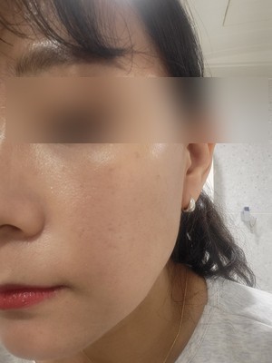 디킨슨 위치하젤 클렌징워터 모공/여드름에 좋은 클렌징