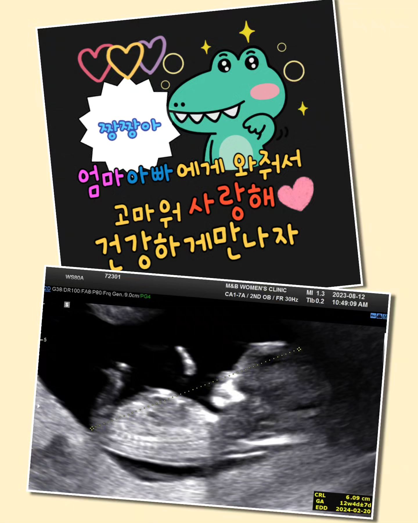 둘째라니💕 

언젠간 한결이 동생 만들어줘야지 했는데 
내년 이사시기에 맞춰서 태어나는 짱짱이 👼

그래서 한결이가 계속 안아달라하고 
걷질 않았구나 . 다 이유가 있었네 

입덧 지옥 입덧인데 왜 살이 붙지? 
내년 2월에 만나자 짱짱아