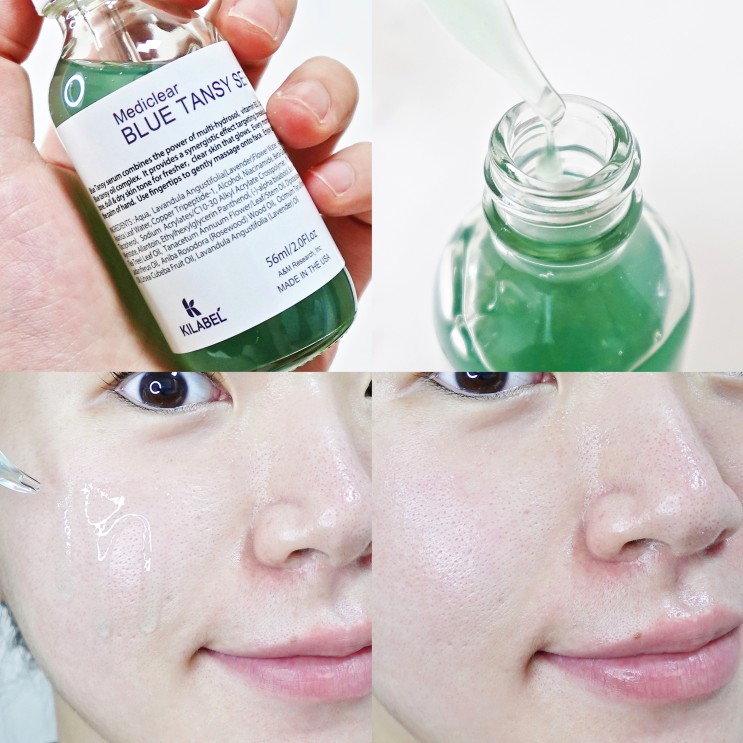 키라벨 블루탄지 세럼 911세럼으로 하는 여름철 트러블, 피부 진정 관리