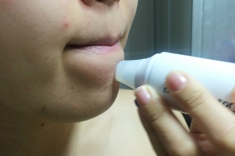 피지 흡입기*메디컬팩토리(포어케어)