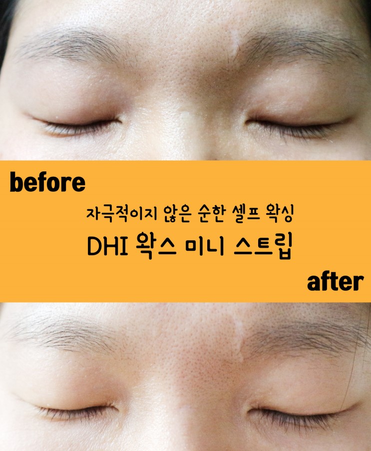 페이스왁싱  DHI, 디에이치아이 왁스 스트립으로 미간제모