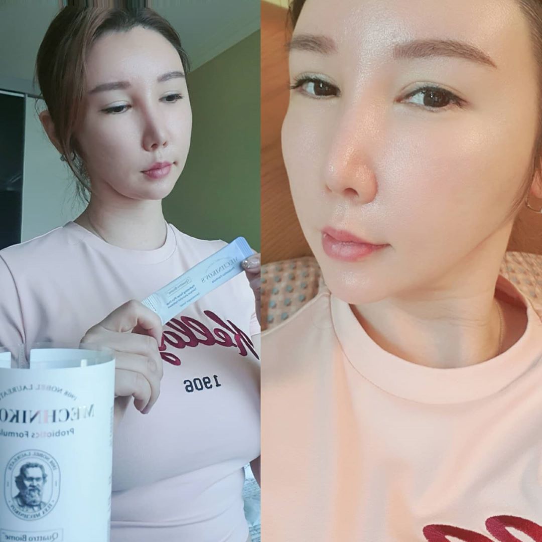 YoonSsam on Instagram: “#광고 유산균 메치니코프 마시는줄말 알았지. 이제 피부에 양보할 때인가요. #유산균 히알루론산 만나 건조함에 수분공급 겨울 다가오는 환절기 #꿀템 따로포장되어 있