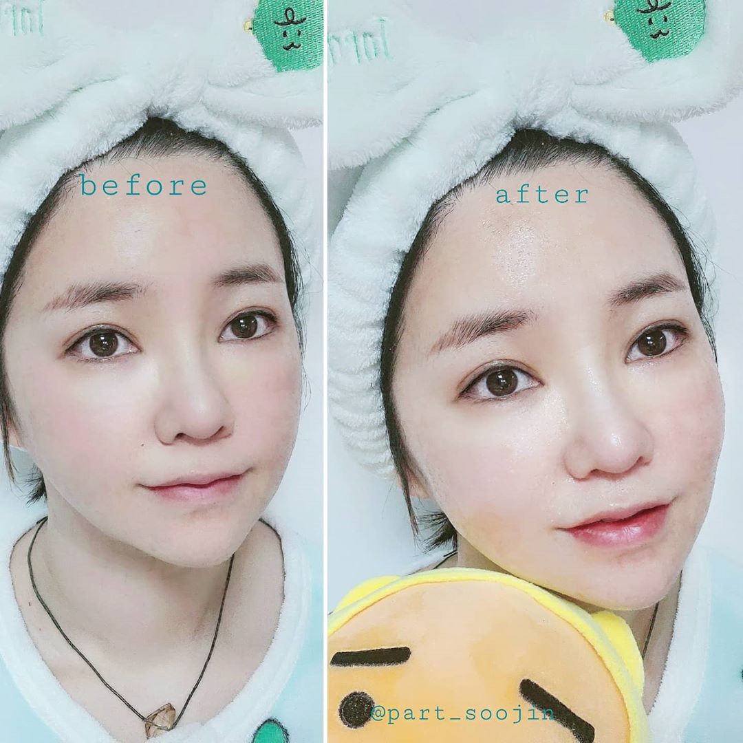 ᴋɪᴍ ѕᴏᴏ ᴊɪɴ on Instagram: “#협찬 메치니코프 프로바이오틱스 포뮬러 하이드레이팅토너 플러스 샷💙 장수 유산균을 최초로 발견한 사람이 생물학자 이자 대학교수였던 메치니코프래