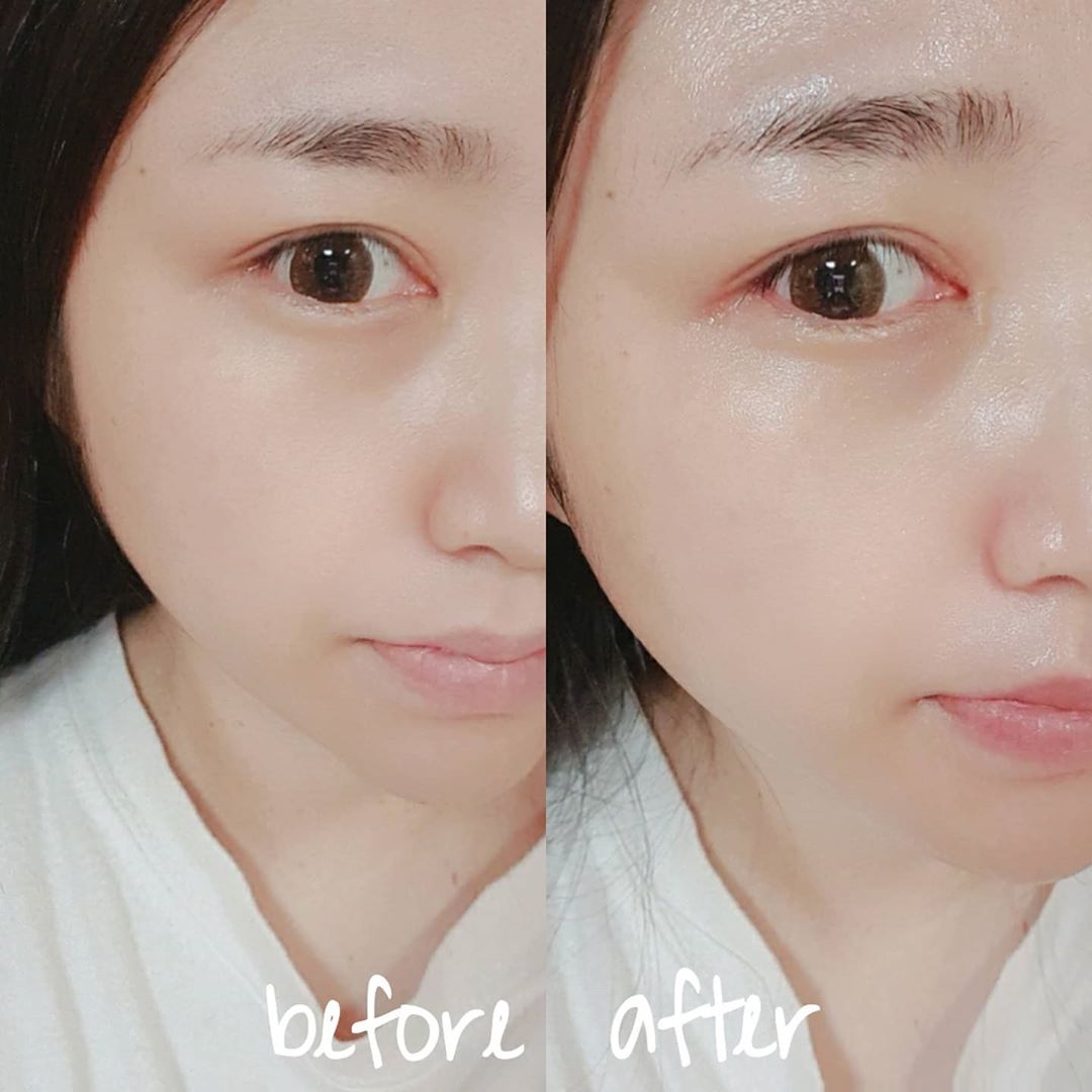 나 0 👑 , ✍하루하루 🌠 on Instagram: “#광고 #협찬 메치니코프 프로바이오틱스 포뮬러 하이드레이팅토너 플러스 샷 ⠀ 유산균 이제 먹지말고 피부에 양보하세용~ 먹는거보다 피부로 흡수시