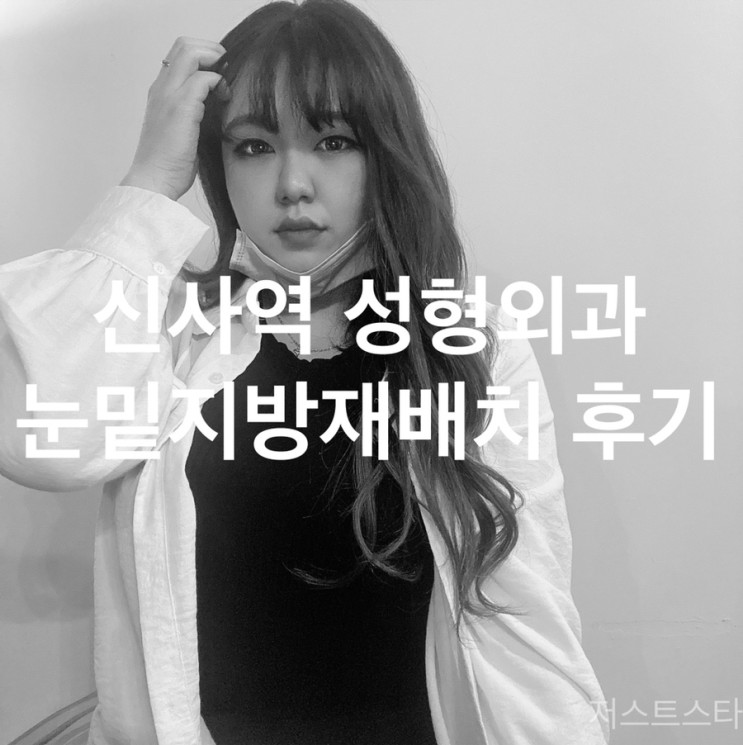 신사역 성형외과에서 눈밑지방재배치 받고 온 10일차 리얼 후기!(사진주의)