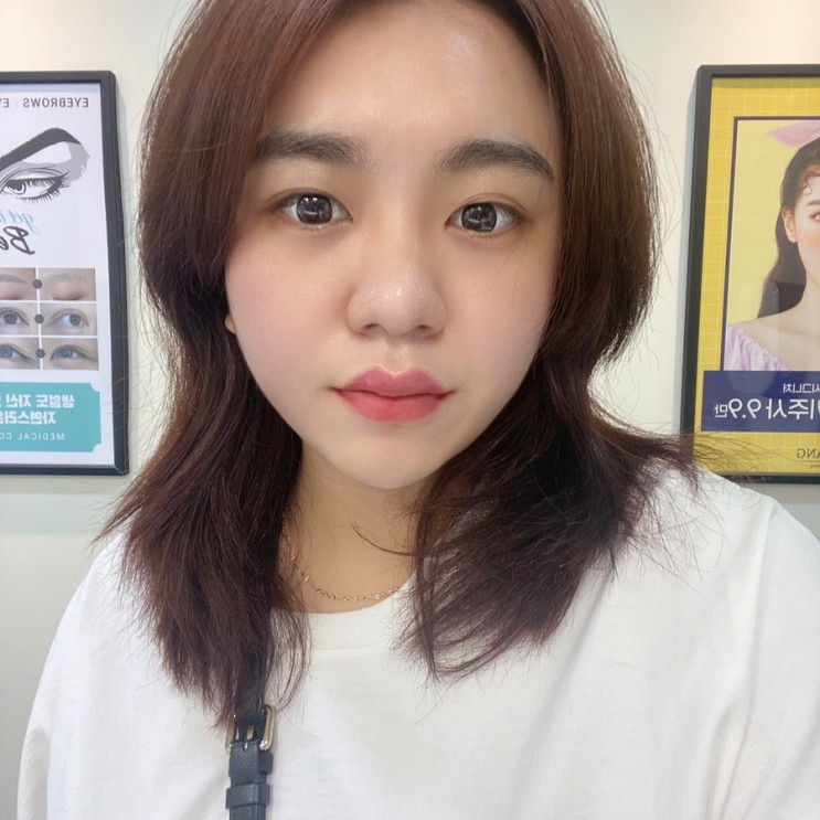 홍대 피부과 인모드리프팅 받고 온 후기