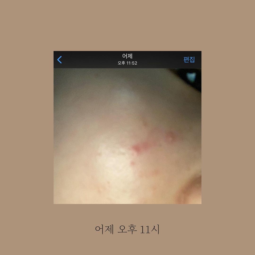 여 유 on Instagram: “#협찬 #무료체험 #제품 *제품의 판매 방식과 전혀 관련 없이 오롯이 제품력에 기반한 후기입니다* 몇 년전 뉴스킨 제품을 직접 구매하고 사용했었을 때 제품 퀄리티가 매