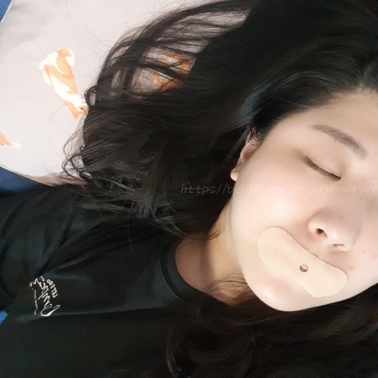 입벌림방지밴드 바른수면밴드 잘 때 입 벌리는 사람 모여라