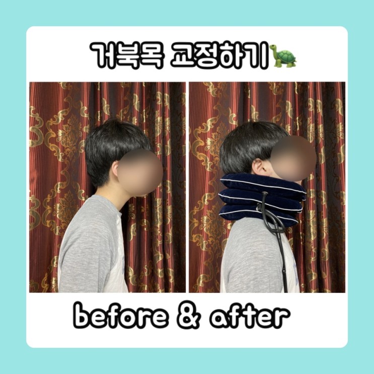 거북목교정기 큐리넥으로 거북목 탈출하기