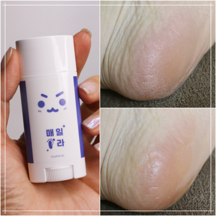 빅클 풋스틱 발뒤꿈치각질제거 손쉽고 빠르게