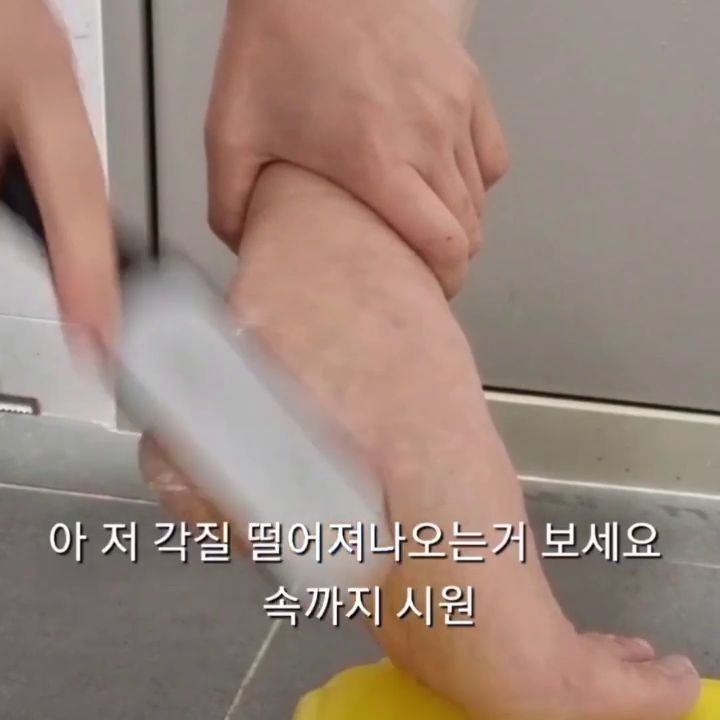 [피나코] 1day 제로 발각질제거제 + 풋파일